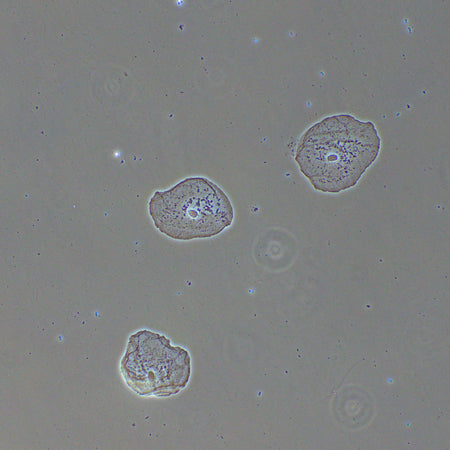 Dispositivo de contraste de fases MAGUS PH2